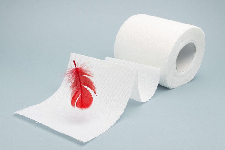 Sangue em papel higiênico é um sinal de hemorróidas